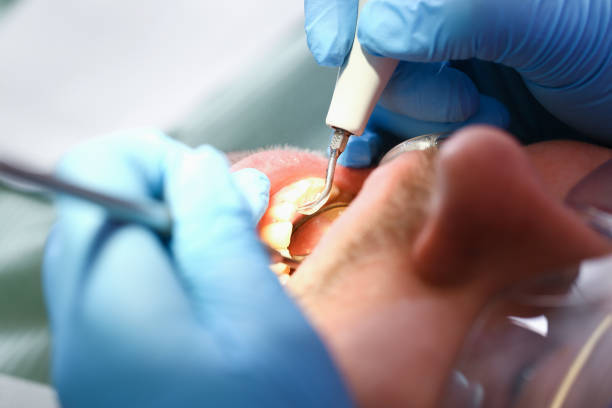 Best Chipped Tooth Repair Near Me  in Woodburn, OR