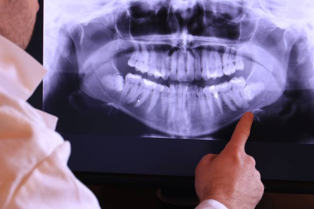 Best Urgent Tooth Repair  in Woodburn, OR